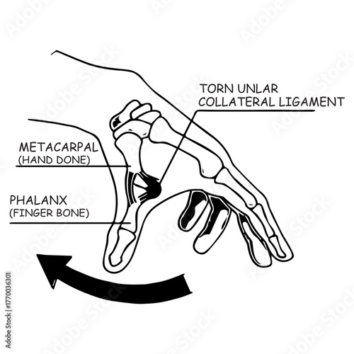 Hand Anatomy