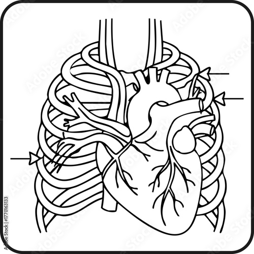Healthcare Heart Bypass Surgery