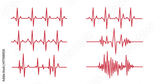 Different stylized red heartbeat lines on a white background, illustrating various normal and abnormal cardiac rhythms.