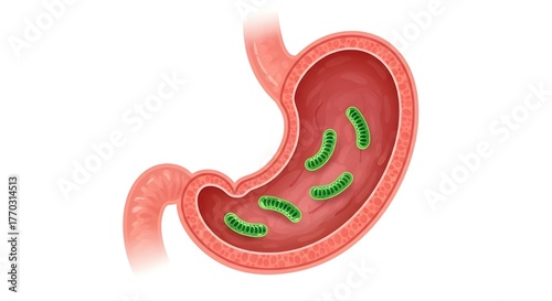 H. Pylori Bacteria in Stomach – Gastric Infection and Digestion Health