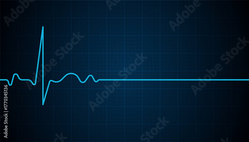 Heart beat pulse electrocardiogram rhythm on blue cardio chart monitor background