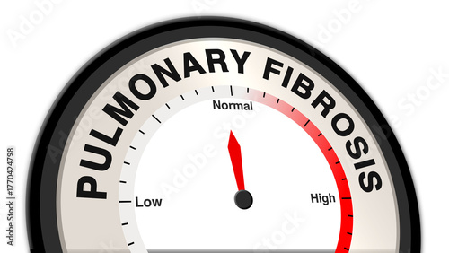 Billede på lærred Pulmonary fibrosis at a moderate level shown on a barometer or tachometer, repre