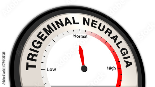 Photos Trigeminal neuralgia at normal severity on a barometer or tachometer, showing mo