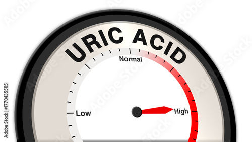 Uric acid at high levels on a barometer or tachometer, indicating symptoms like joint pain, swelling, and risk of gout flare-ups, requiring urgent medical intervention and management