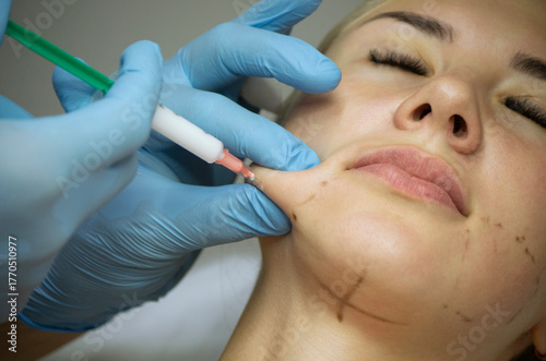 doctor gives beauty injections to a woman