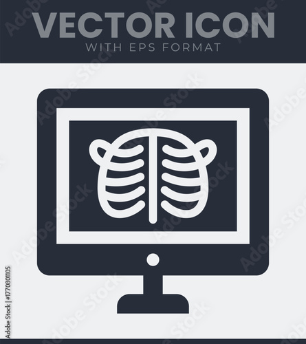Digital x-ray scan of ribs displayed on modern computer screen
