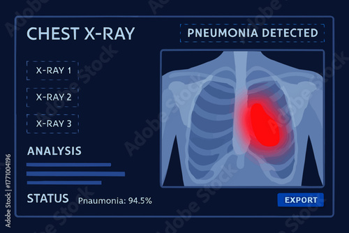 Vector of digital chest X-ray interface with pneumonia detection overlay