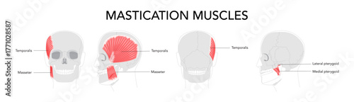 Set of Chewing muscles labeled diagram, masseter, temporalis, medial and lateral pterygoid, jaw movement, mandibular function, human head anatomy, facial expression, dentistry, clinical, scientific.
