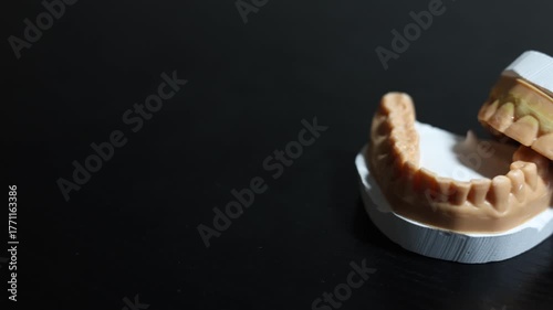Dental Molds On Display