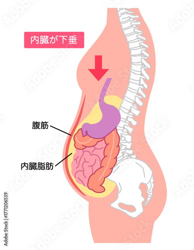 内臓下垂　内臓の位置が下がっている状態
