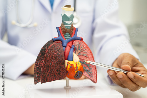 Pneumonia, lung cancer, Asian doctor holding human anatomy model for study diagnosis and treatment in hospital.
