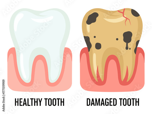 Healthy tooth and damaged tooth in flat style