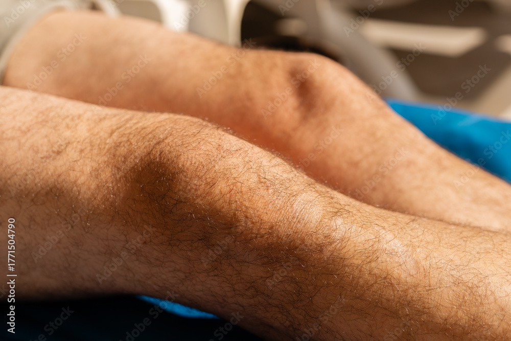 Fototapeta premium Close-up of male legs highlighting various hair textures and colors. Natural light enhances the details, showcasing a realistic view of hair growth patterns and skin