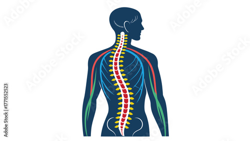 Illustration of human spine exhibiting scoliosis condition
