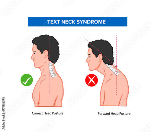 Chin Tuck Head Text Neck Lift Stock Vector Illustration