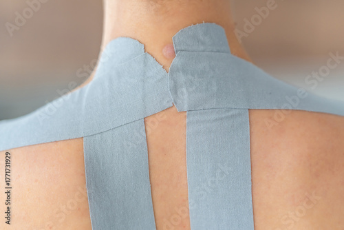 Close-up view of kinesiology tape applied to the neck and shoulder area of a woman. Physical therapy and muscle support through modern rehabilitation techniques