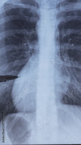 Doctor learning vertical X-ray of humans chest and inside soft tissues.