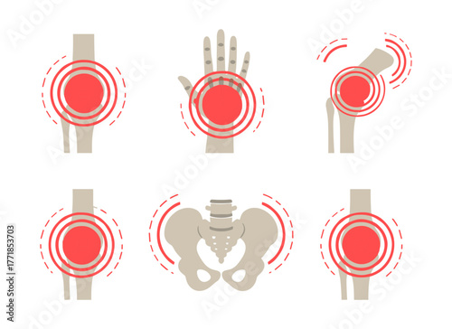 Human skeleton joints suffering from bone pain illustration