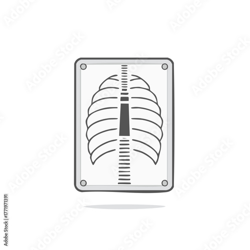 Chest X-ray Radiograph Illustration Medical Imaging Rib Cage Anatomy Diagnostics Healthcare Science