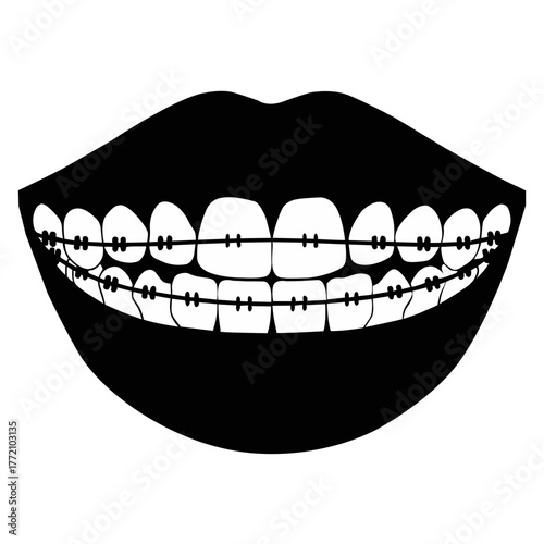 Dental Care Vector. Orthodontic Teeth Illustration. Dentistry Icon for Clinic