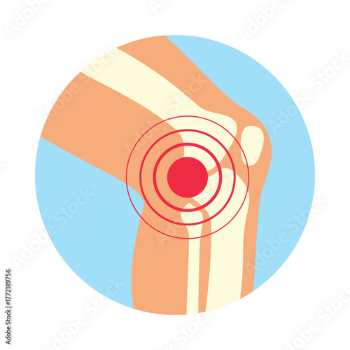 Rheumatoid arthritis knee pain representation in vector design for health awareness and education