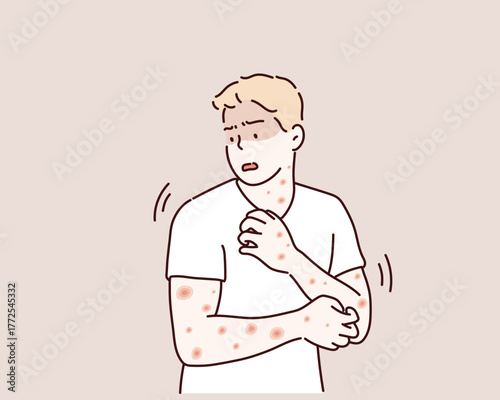 Man with red rash and skin allergy on body, itching and sensitive skin care concept, Hand drawn style vector design illustrations.