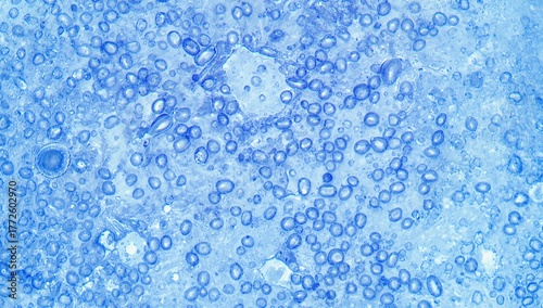 Microscopic view at 100X magnification of a sputum sample stained by Gram method showing white blood cells and many gram-positive rod-shaped bacteria (Selective focus).