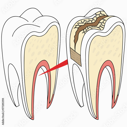 A 3D render of healthy vs. decayed teeth comparison.