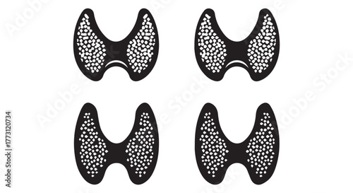 Four stylized thyroid gland icons with textured fill isolated on transparent background