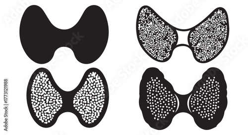 Diagram illustrating different thyroid gland conditions, isolated on transparent background