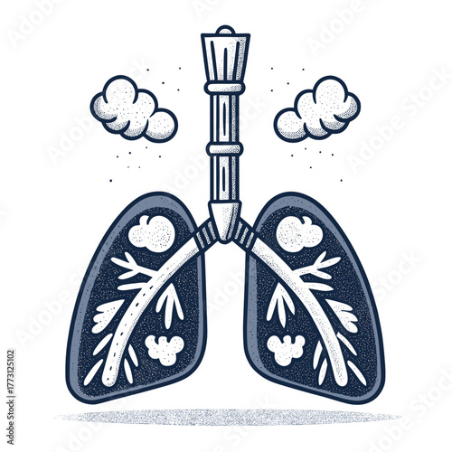 X-ray illustration of lungs with pneumonia and cloud motifs  