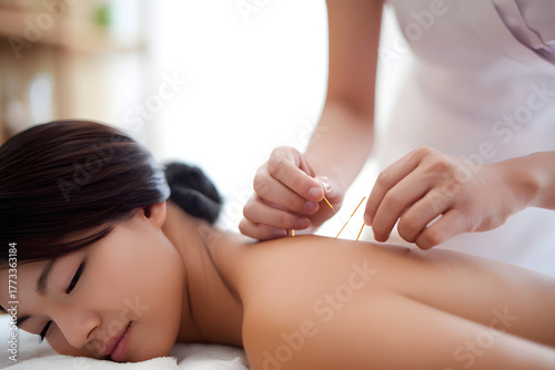 Relaxation scene of Asian woman receiving cosmetic acupuncture