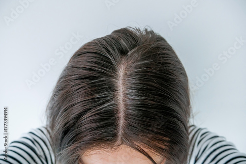 Close-up of a woman's scalp with visible gray hair roots and regrowth, showing hair parting and early signs of hair thinning – concept of aging, scalp health, and hair care treatment
