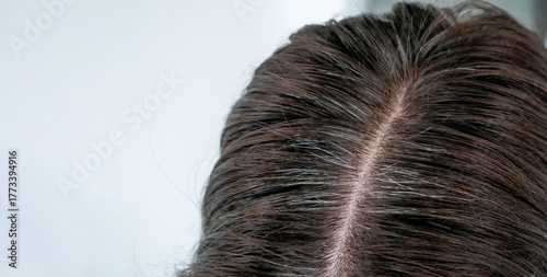 Cuadro en lienzo Close-up of a woman's scalp with visible gray hair roots and regrowth, showing h