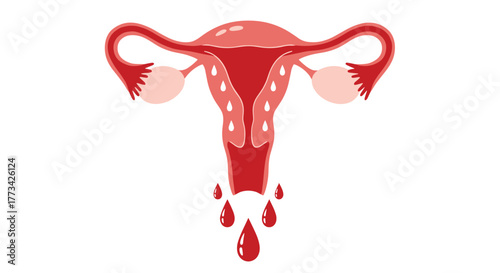 Illustration of the female reproductive system with blood drips, symbolizing menstruation or uterine bleeding.