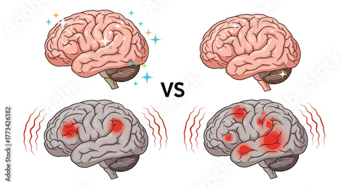 Illustration comparing a healthy, sparkling brain with a brain showing signs of stress and damage.