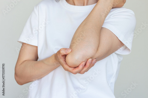 Tableau sur toile Young caucasian woman in white tshirt holding the elbow joint, experiencing pain from arthritis, elbow injury