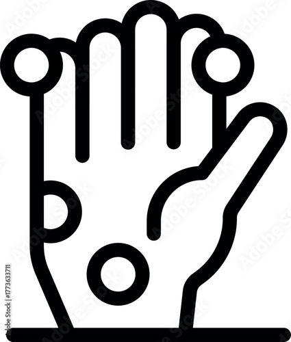 Open hand showing circular blisters, a symptom of monkeypox or chickenpox