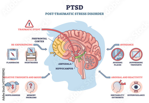 PTSD brief diagram shows trauma s effects on the brain, spotlighting amygdala and hippocampus, with flashbacks, avoidance, and hypervigilance. Brain, amygdala, hippocampus. Outline diagram
