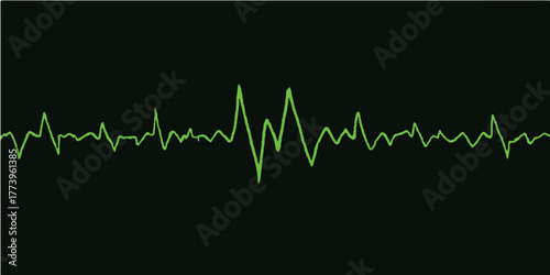 Medical EKG heartbeat graph vector illustration of a healthy pulse line on a hospital monitor screen