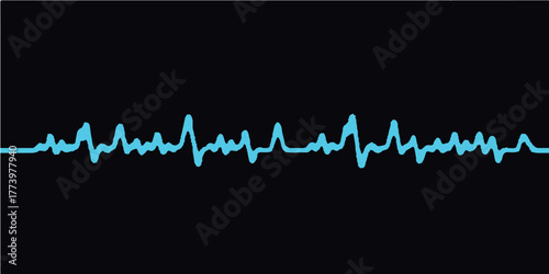 Abstract digital graphic of a green heartbeat wave line on a medical EKG monitor showing the pulse rate and health cardiogram