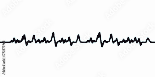 Vector illustration of a cardiogram heartbeat graph design with an arrow symbol showing stock market growth concept