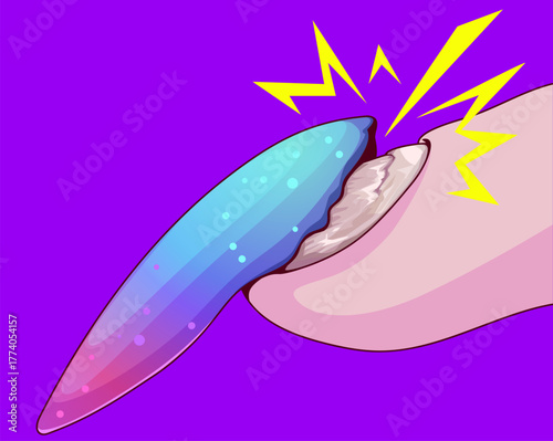 Nail plate disease.  Broken nail. Healthcare illustration. Vector illustration. 