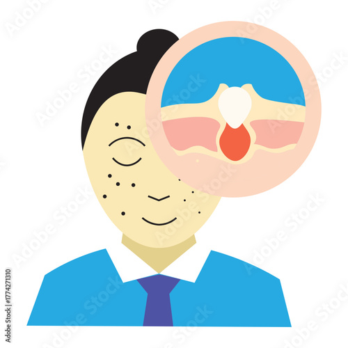 Pimple Skin Problem illustration