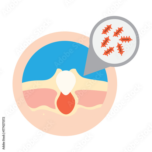 Cutibacterium acnes on Human Skin