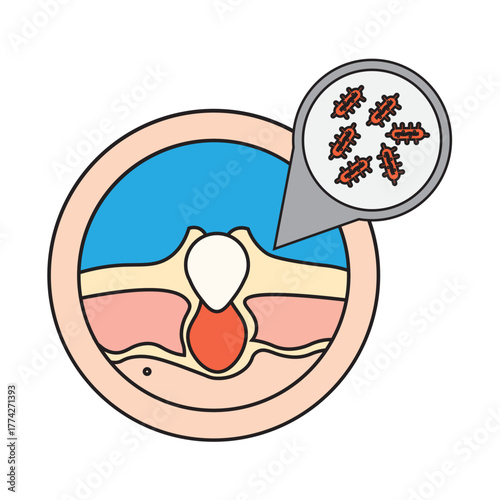 Cutibacterium acnes on Human Skin