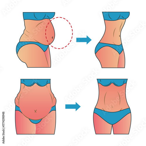 Woman body before and after weight loss vector illustration