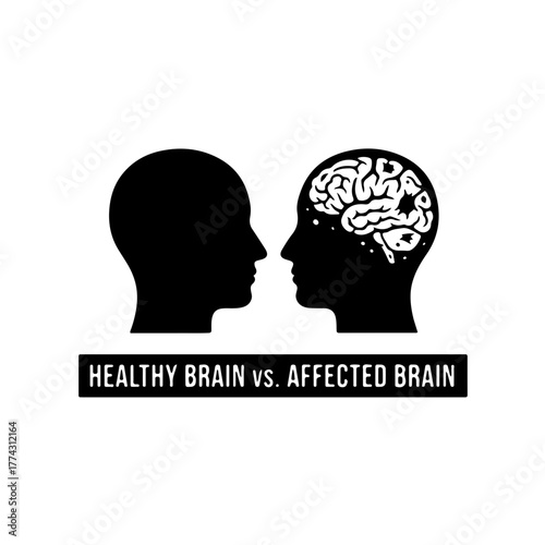 Brain Health vs. Addiction Damage: Minimalist vector graphic comparing two side-by-side brain profiles; one clean and one showing cracks/voids, emphasizing the cognitive harm from narcotics