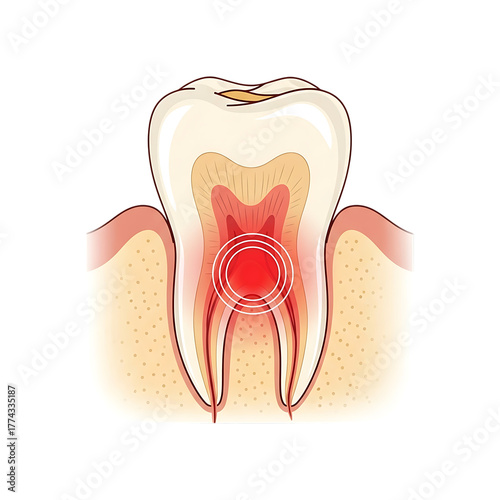 Crosssection of a human tooth showing pulp and root with pain indicator isolated on transparent background