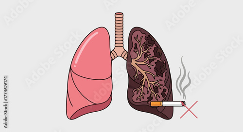 Illustration of unhealthy lungs with a cigarette symbolizing the harmful effects of smoking on respiratory health